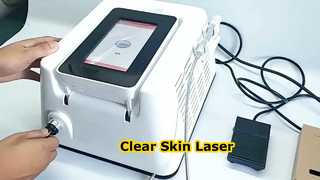 Mesin Penghilang Tag Kulit Vena Laba-laba Laser 980nm