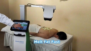 Pengurangan Lemak Pelangsing Tubuh Laser 10D