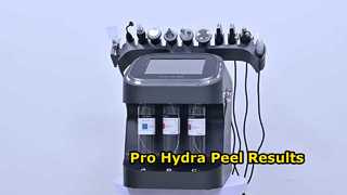Hasil Pro Stasiun Kerja Hydra Aqua Peel 10-In-1
