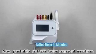 Mesin Penghilang Tato Laser Picosecond Ringkas & Bertenaga